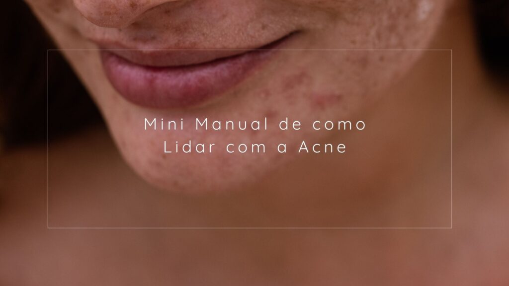 Mini Manual de como lidar com a Acne